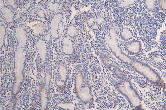 Acetyl-HIST1H3A Recombinant Monoclonal Antibody