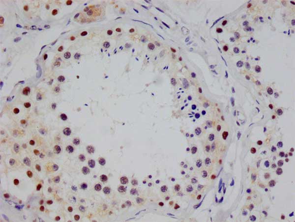 STAT4 Recombinant Monoclonal Antibody