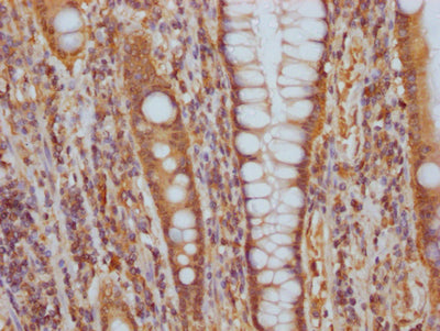 ITGAV Recombinant Monoclonal Antibody