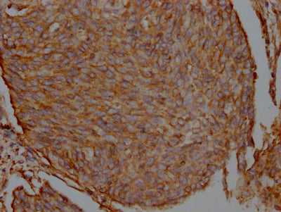 FLNA Recombinant Monoclonal Antibody
