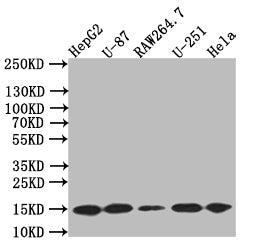 MAP1LC3B Recombinant Monoclonal Antibody