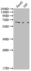 ACVRL1 Recombinant Monoclonal Antibody