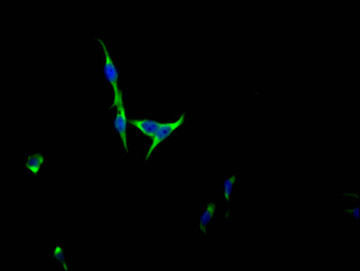 FGFR3 Recombinant Monoclonal Antibody