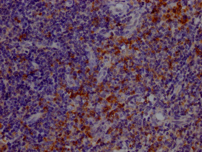 TLR7 Recombinant Monoclonal Antibody