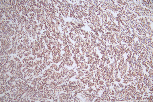 LEF1 Recombinant Monoclonal Antibody