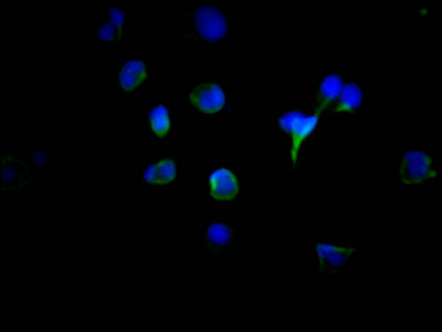TYR Recombinant Monoclonal Antibody