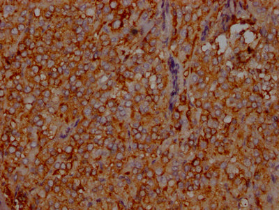 LDLR Recombinant Monoclonal Antibody