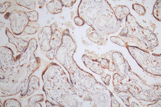 NAIP Recombinant Monoclonal Antibody