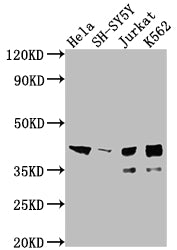 ISL1 Recombinant Monoclonal Antibody