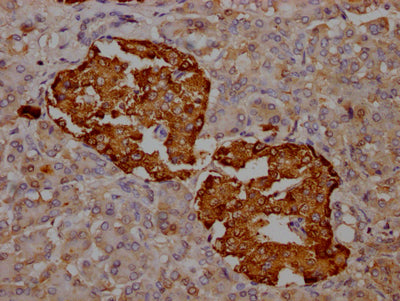 TTR Recombinant Monoclonal Antibody