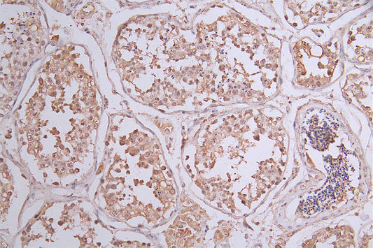 Phospho-ERBB2 (Y1139) Recombinant Monoclonal Antibody