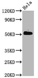 Phospho-CDC37 (S13) Recombinant Monoclonal Antibody