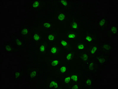 Phospho-SMAD2 (S255) Recombinant Monoclonal Antibody