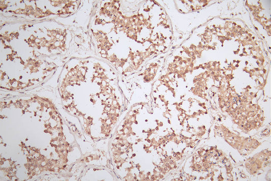 WDR5 Recombinant Monoclonal Antibody