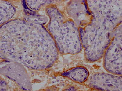 TPBG Recombinant Monoclonal Antibody