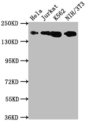 TOP2A Recombinant Monoclonal Antibody