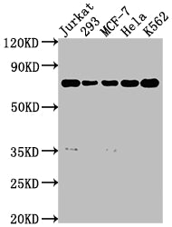 PTPN11 Recombinant Monoclonal Antibody