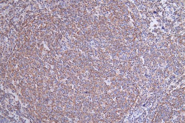 CR1 Recombinant Monoclonal Antibody