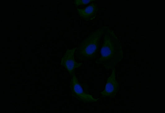 KRT6A Recombinant Monoclonal Antibody