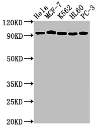 TOP1 Recombinant Monoclonal Antibody