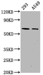Phospho-PRKAA2 (S491) Recombinant Monoclonal Antibody