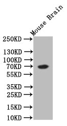 CHAT Recombinant Monoclonal Antibody