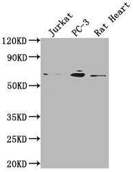 E2F1 Recombinant Monoclonal Antibody