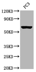 CHRM3 Recombinant Monoclonal Antibody