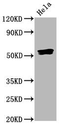 Phospho-SMAD5 (S463/S465) Recombinant Monoclonal Antibody