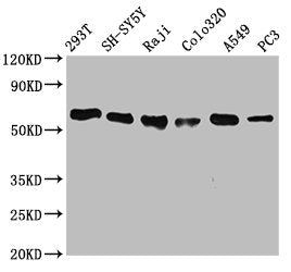 FTO Recombinant Monoclonal Antibody
