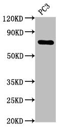 TP63 Recombinant Monoclonal Antibody