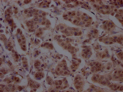 CUL3 Recombinant Monoclonal Antibody