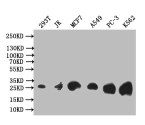 TK1 Recombinant Monoclonal Antibody