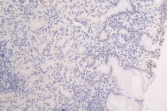 Mutated-HIST1H3A (K27) Recombinant Monoclonal Antibody