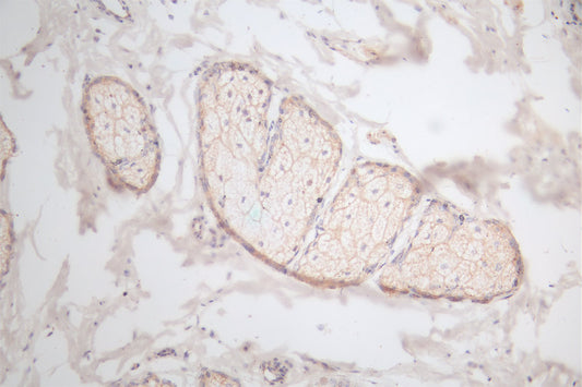 EGF Recombinant Monoclonal Antibody