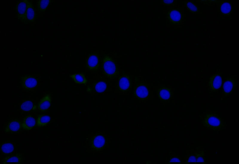 LYVE1 Recombinant Monoclonal Antibody