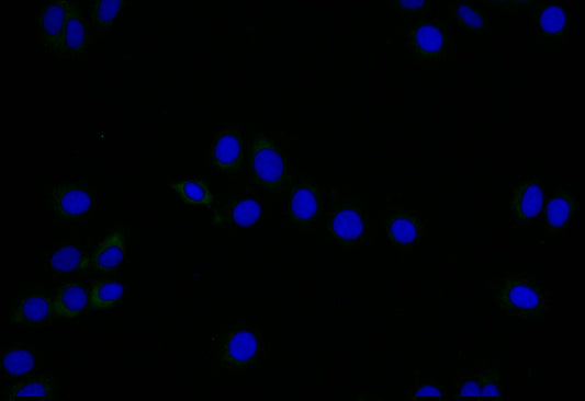 LYVE1 Recombinant Monoclonal Antibody