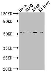 ILK Recombinant Monoclonal Antibody