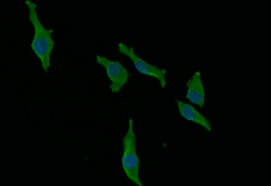 AGO2 Recombinant Monoclonal Antibody