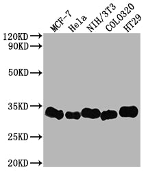 LGALS3 Recombinant Monoclonal Antibody