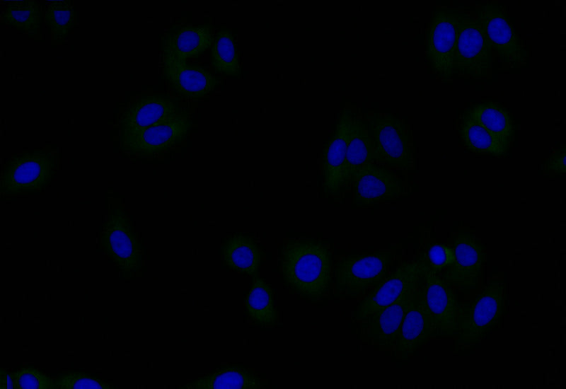 GSN Recombinant Monoclonal Antibody