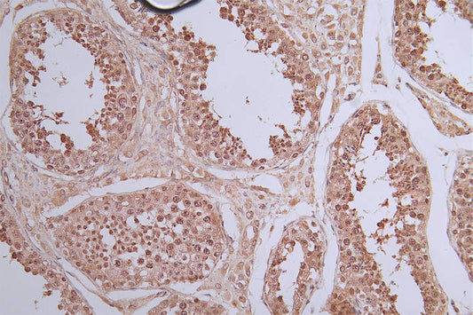 STAT1 Recombinant Monoclonal Antibody