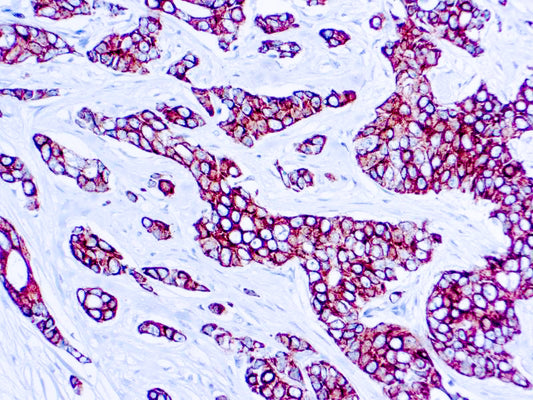 Cytokeratin (CAM5.2)