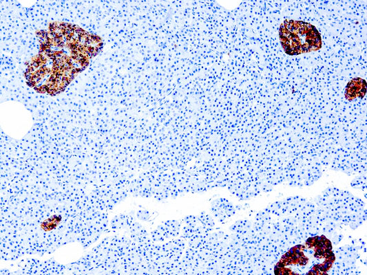 Chromogranin A