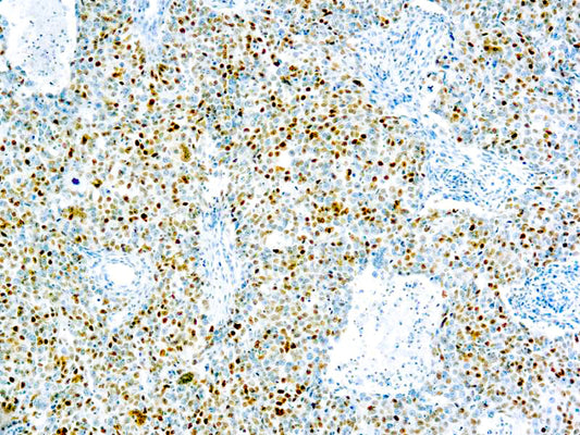 Cyclin E Protein