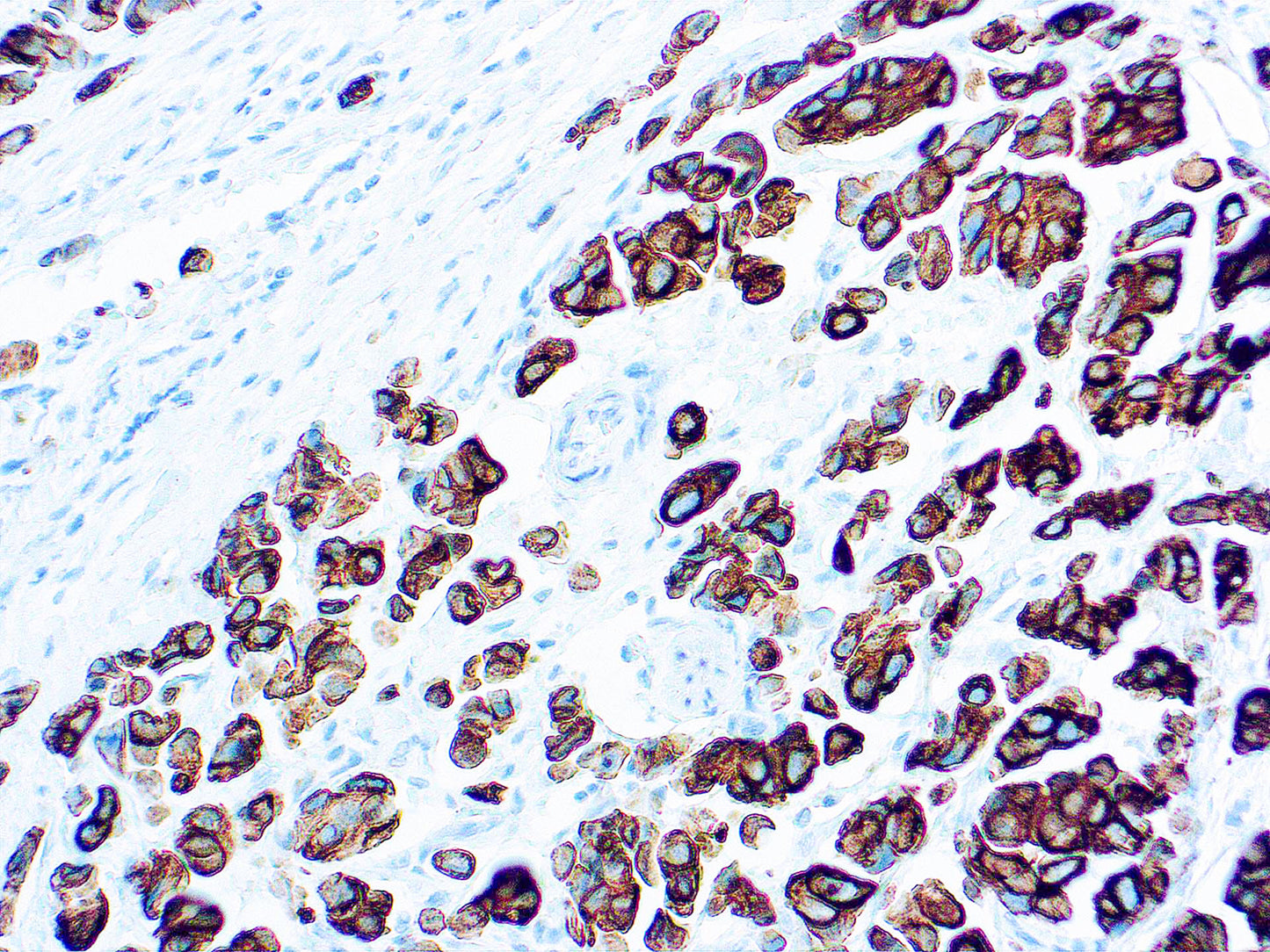 Cytokeratin 20