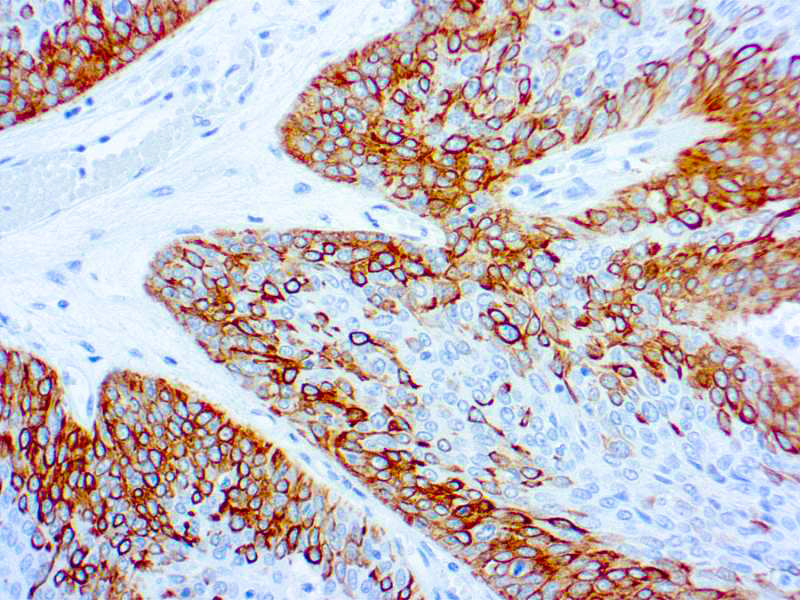 Cytokeratin 14