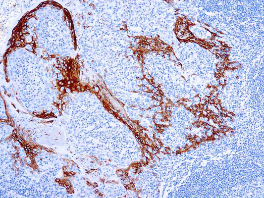 Cytokeratin 16