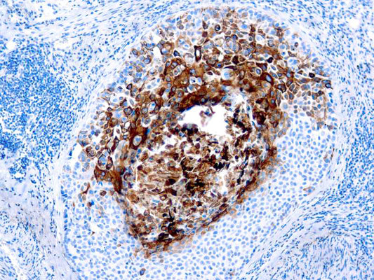 Cytokeratin 17