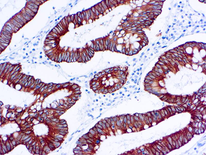 Cytokeratin 18